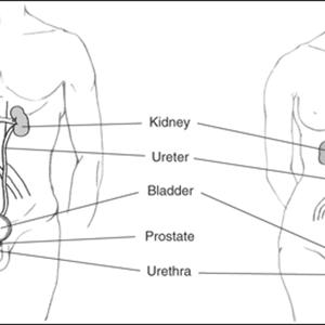 Symptoms Uti - Irritable Bladder: What Is It? How To Avoid It?