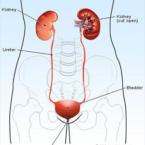 Cure Uti - Different Stages Of Kidney Infections