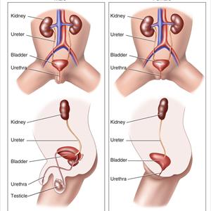 Strong Smelling Urine Group - Uti Natural Cure - Naturally Treat Urinary Tract Infection Before Kidney Damage